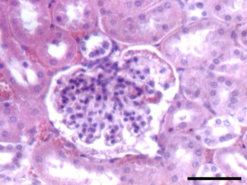 Corpúsculo renal