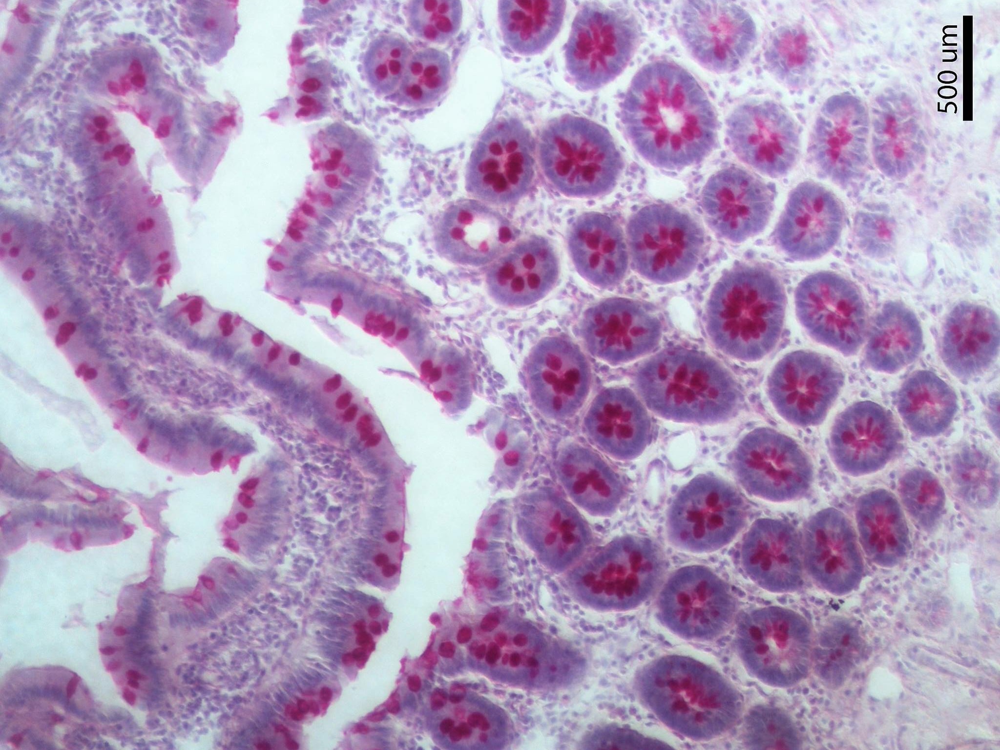 Mucosa del intestino delgado. PAS-Hematoxilina