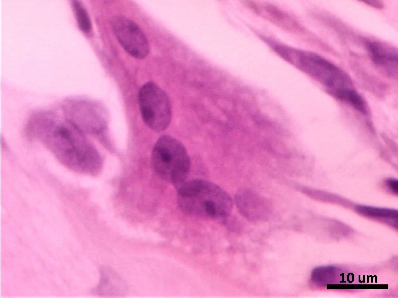 Osteoclasto 