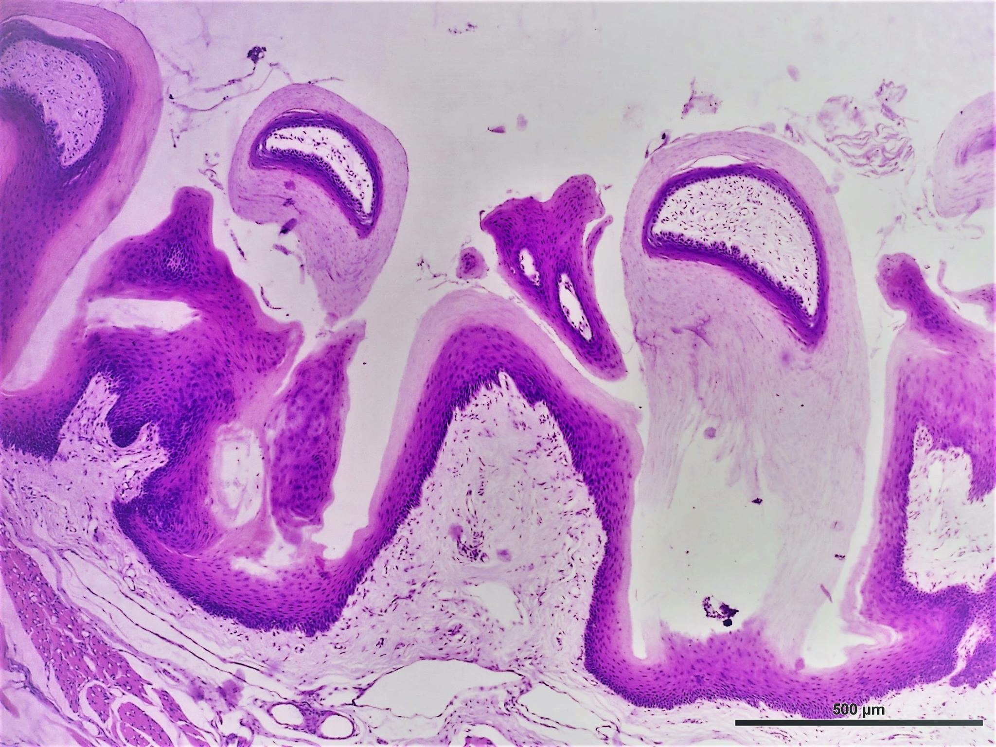 Mucosa lingual