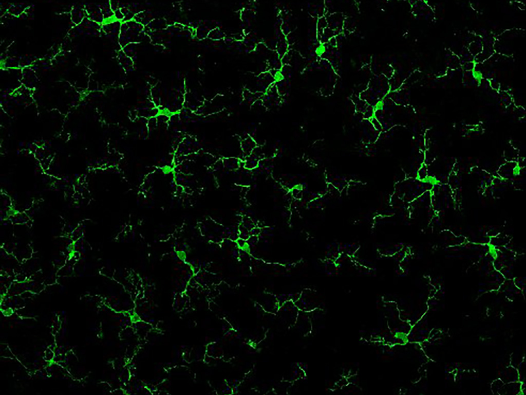 Inmunohistoquímica para Iba-1 (marcador de microglía) en cortes de médula espinal lumbar de rata. Laboratorio de Neurobiología Celular y Molecular.