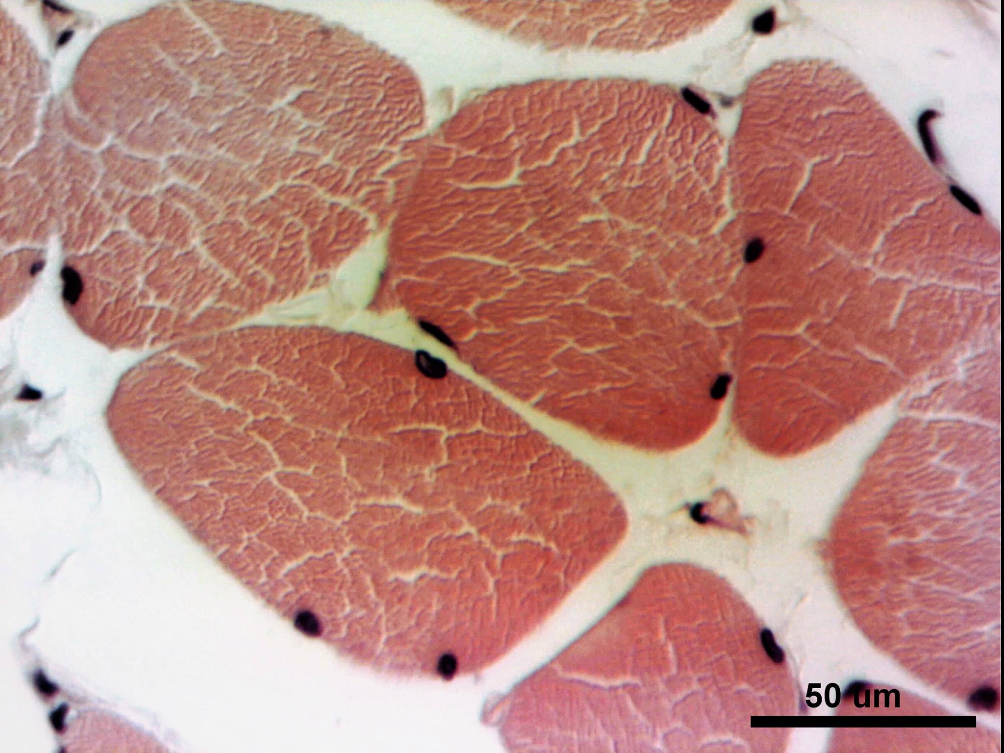 Fibras musculares estriadas esqueléticas